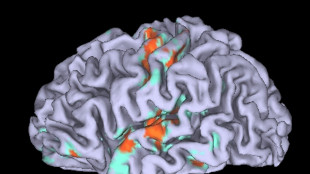 Trovata la regione del cervello che fa predicare bene e razzolare male