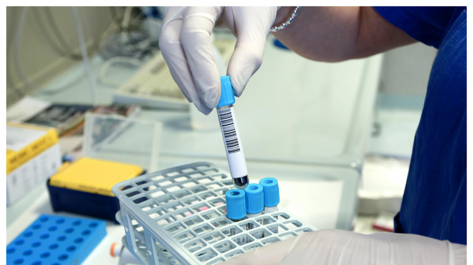 Un eccesso del dolcificante xilitolo nel sangue associato a rischio di infarto o ictus