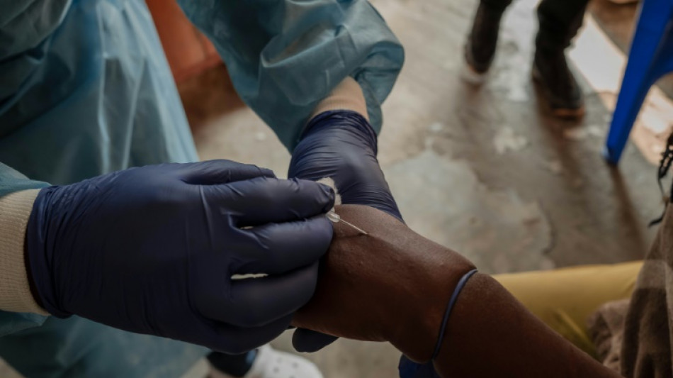 OMS pede aumento da produ&ccedil;&atilde;o de vacinas contra mpox