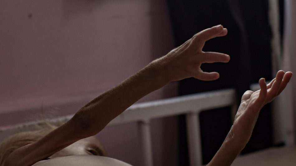 Wafa, '6 morti per malnutrizione a Gaza nelle ultime 24 ore'