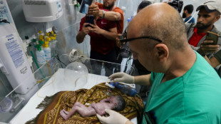 M&eacute;dicos de Gaza salvam beb&ecirc; por meio de ces&aacute;rea