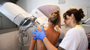 Nouvelle recommandation pour des mammographies d&egrave;s 40 ans aux Etats-Unis